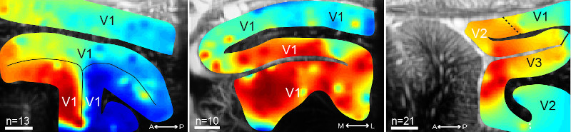 New advances in functional ultrasound imaging for neuroscience