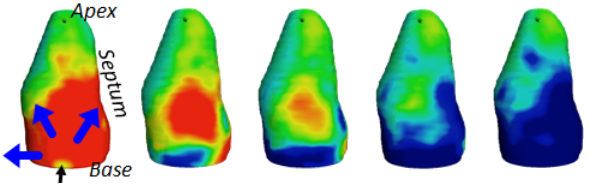 3D ultrafast echocardiography: full characterization of cardiac functions within a heartbeat