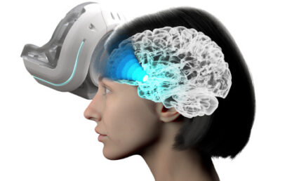 A new approach to treat severe depression using focused ultrasound