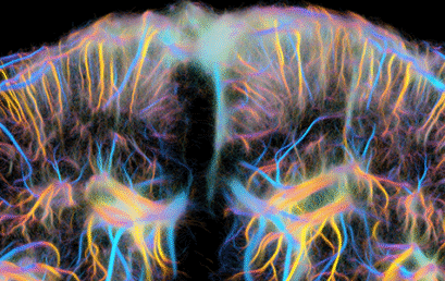 Non-invasive characterization of pericyte dysfunction in mouse brain using functional ultrasound localization microscopy: a major advance for diagnosing vascular and neurovascular alterations
