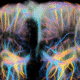 Functional Ultrasound Localisation Microscopy provides unique and non invasive information about local hemodynamics in cerebral microvessels for