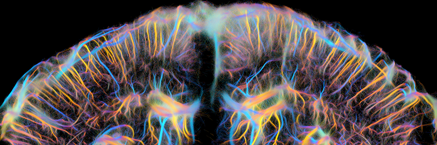 Non-invasive characterization of pericyte dysfunction in mouse brain using functional ultrasound localization microscopy: a major advance for diagnosing vascular and neurovascular alterations Non-invasive characterization of pericyte dysfunction in mouse brain using functional ultrasound localization microscopy: a major advance for diagnosing vascular and neurovascular alterations