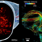 Imaging the brain through the skull: a comprehensive review