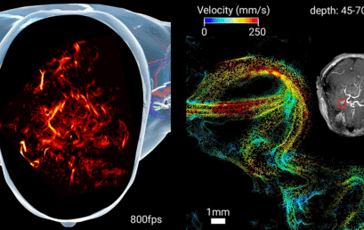 Imaging the brain through the skull: a comprehensive review