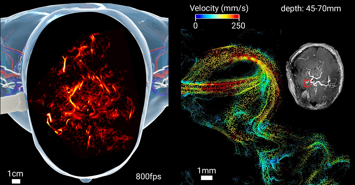 Imaging the brain through the skull: a comprehensive review