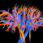Major breakthrough in medical imaging just published in Nature Communications