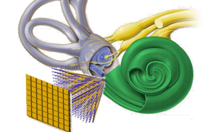 Research Internship – Simulation of ultrasound propagation in the human cochlea for neuromodulation of ganglionar cells in hearing restoration