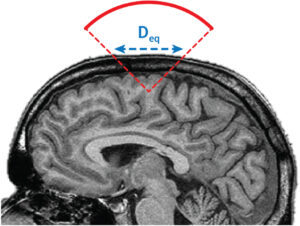 A new consensus paper co-authored by Jean-François Aubry and David Attali has been recently published in Brain Stimulation: “ITRUSST Consensus on Biophysical Safety for Transcranial Ultrasound Stimulation”