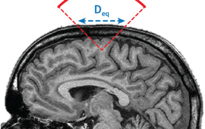 Toward global safety standards for transcranial ultrasound stimulation: new publication in Brain Stimulation Toward global safety standards for transcranial ultrasound stimulation: new publication in Brain Stimulation
