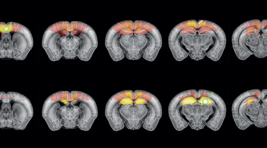 fUSbrain_carrousel_bertolo2023