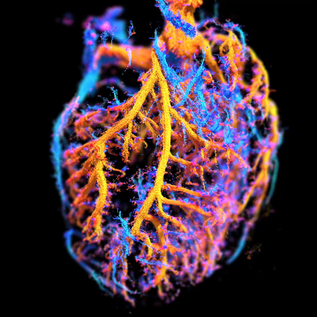 Stage – Algorithme haute performance de reconstruction pour l’échographie 3D ultrarapide Stage – Algorithme haute performance de reconstruction pour l’échographie 3D ultrarapide