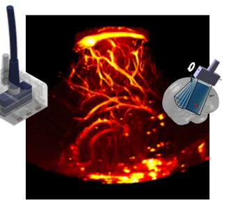 Neuroimaging in Neonates using Functional Ultrasound (fUS) Neuroimaging in Neonates using Functional Ultrasound (fUS)